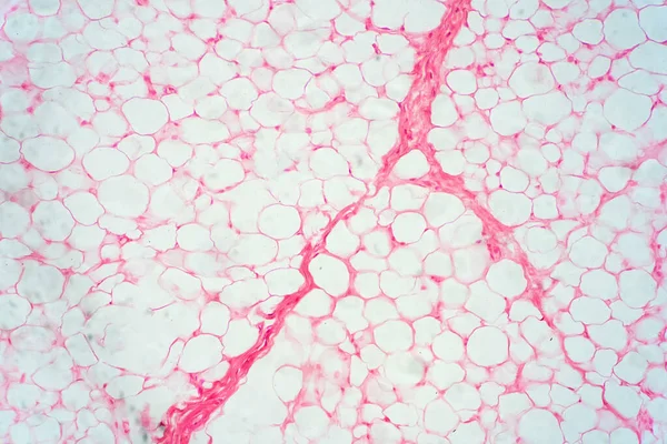 Tejido Corporal Grasa Humana Bajo Vista Microscopio Para Educación Fisiológica — Foto de Stock