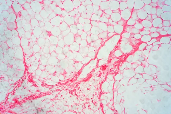 Menselijk Vet Lichaamsweefsel Onder Microscoop Bekijken Voor Fysiologie Onderwijs — Stockfoto