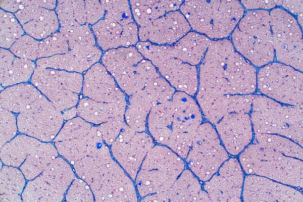 顕微鏡ビューの下で人間の目の神経 人間の生理学の歴史 — ストック写真