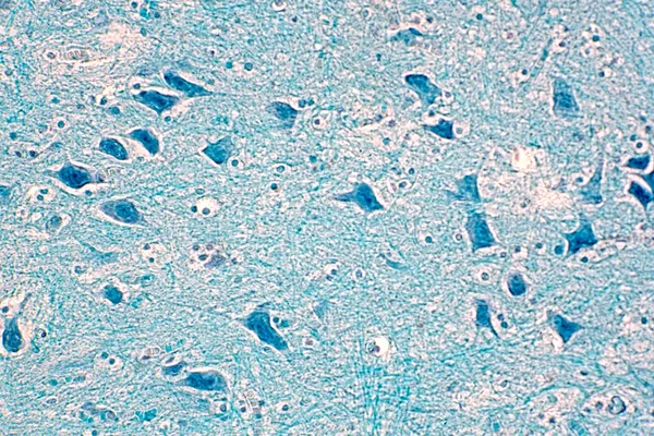 Sezione Trasversale Del Midollo Spinale Microscopio Istologico Fisiologia Umana — Foto Stock