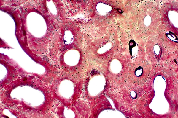 肌肉连接和结缔组织显微镜下人体骨组织的组织学研究 — 图库照片