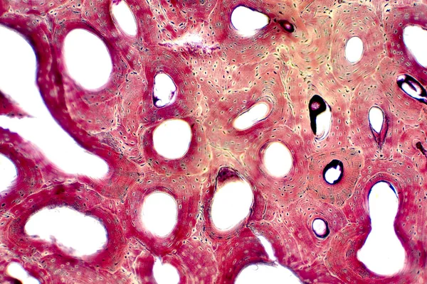 Histologie Van Menselijk Compact Botweefsel Onder Microscoop Voor Onderwijs Spierbotverbinding — Stockfoto