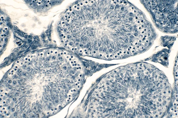 Поперечний Переріз Тести Людини Під Мікроскопом Показує Сперматогонію Сперматоцити Мейозі — стокове фото