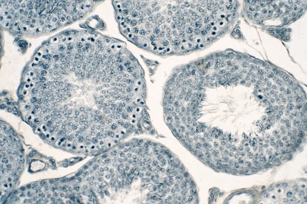 Emberi Herék Keresztmetszete Mikroszkóp Alatt Mutatja Spermatogonia Spermatociták Meiosis Spermatidok — Stock Fotó