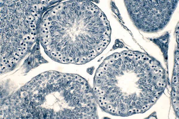 Emberi Herék Keresztmetszete Mikroszkóp Alatt Mutatja Spermatogonia Spermatociták Meiosis Spermatidok — Stock Fotó