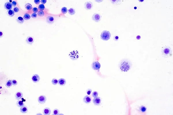 教育のための顕微鏡観察下の血液からのヒト染色体 — ストック写真