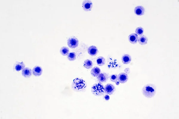 Хромосомы Человека Крови Микроскопом Образования — стоковое фото