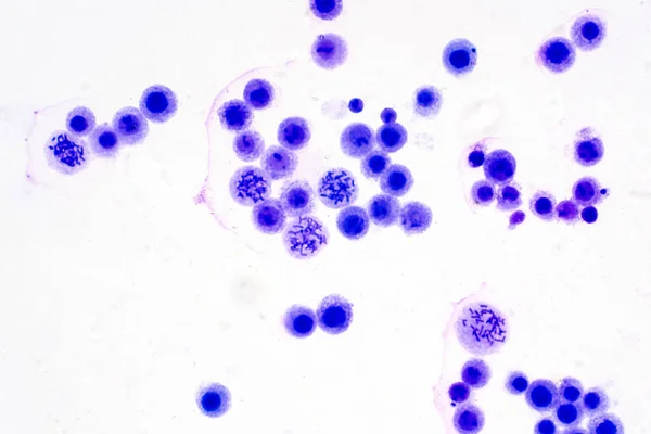Humana Kromosomer Från Blod Mikroskop För Utbildning — Stockfoto
