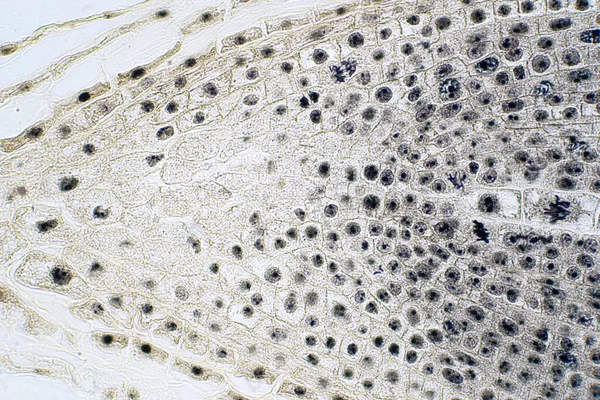 Korzeń Końcówki Cebuli Mitozy Komórki Korzeń Wskazówka Dla Edukacji — Zdjęcie stockowe