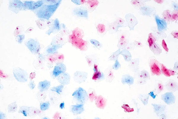 Células Epiteliais Escamosas Sob Visão Microscópica Para Estudo Histológico Tecidos — Fotografia de Stock