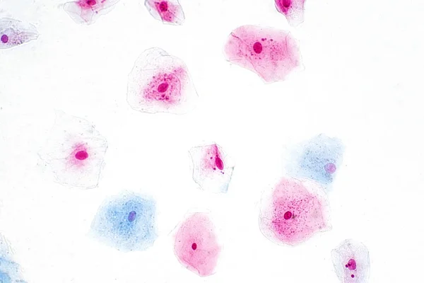 培养组织学显微镜下的鳞状上皮细胞 人体组织 — 图库照片