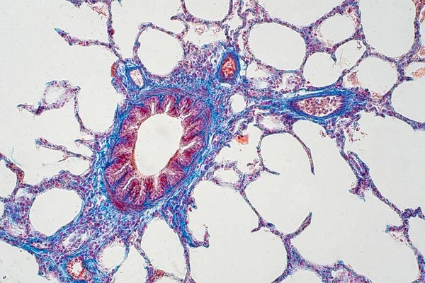 Tecido Pulmonar Humano Sob Visão Microscópica Pulmões São Órgãos Primários — Fotografia de Stock