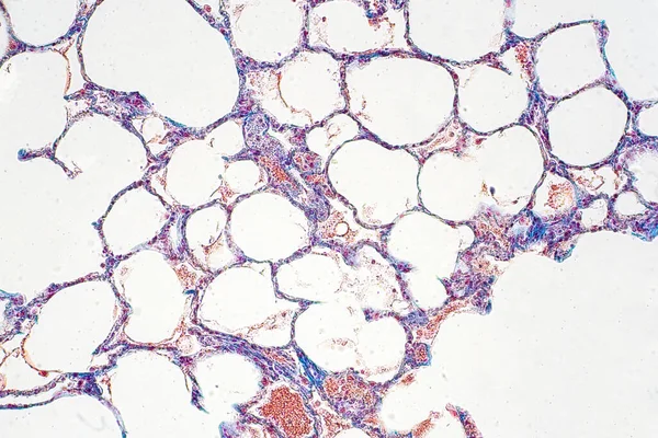 Tecido Pulmonar Humano Sob Visão Microscópica Pulmões São Órgãos Primários — Fotografia de Stock