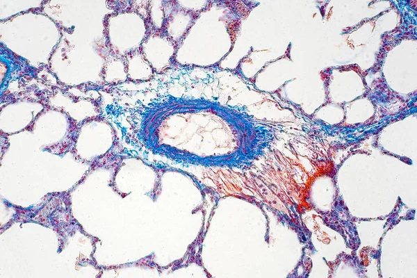 Тканини Легень Людини Під Мікроскопом Легені Основними Органами Дихальної Системи — стокове фото