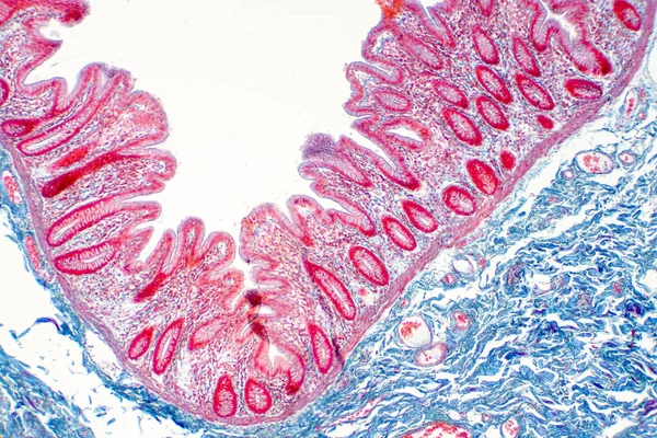 Tecido Intestinal Grosso Humano Sob Visão Microscópica Histológico Para Fisiologia — Fotografia de Stock