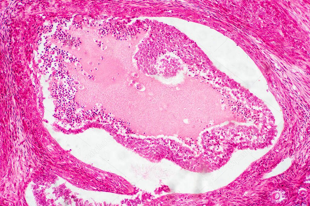 Light microscopic of human ovary showing primary and secondary follicles. Human physiology education.