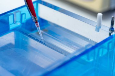 DNA örneği metodu için moleküler teknik jel elektroforezi genetik kodu çözer. Laboratuvarda biyokimya ve klinik kimya.