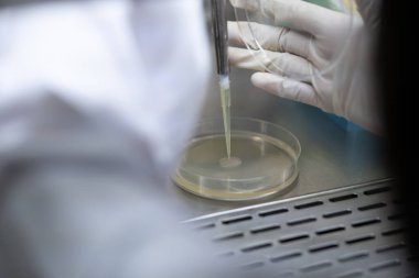 Mikrobiyolog laboratuardaki medya kültürü plakası üzerine test yapıyor..