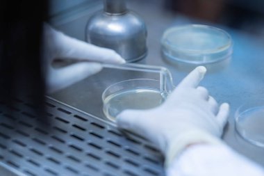 Mikrobiyolog laboratuarda medya kültürü tabakasına yayılıyor..