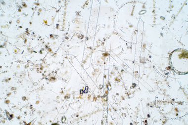 Mikroskop altında deniz planktonları.