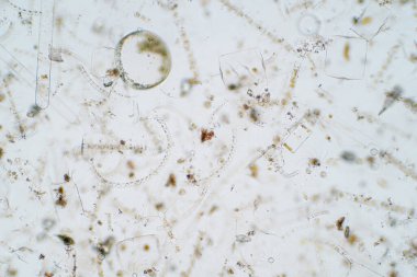 Mikroskop altında deniz planktonları.