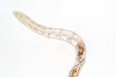 Eğitim için mikroskop altında Tubifex solucanı.