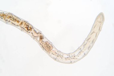 Eğitim için mikroskop altında Tubifex solucanı.