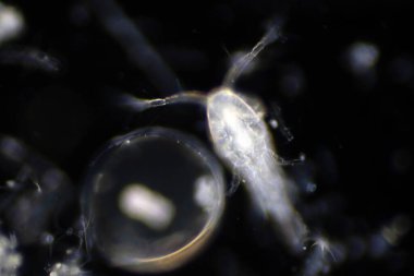 Planktonlar okyanuslarda ve denizde sürüklenen organizmalardır. Zooplankton.