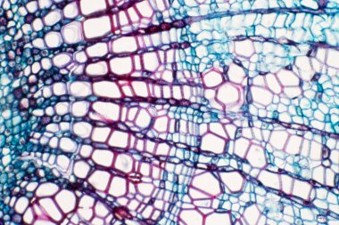 Çapraz kesit - Xylem, damar bitkilerinde su ve besin taşıyan bir doku türüdür. Bilimsel araştırma. Bitki dokusu yapısı.