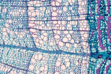 Çapraz kesit - Xylem, damar bitkilerinde su ve besin taşıyan bir doku türüdür. Bilimsel araştırma. Bitki dokusu yapısı.