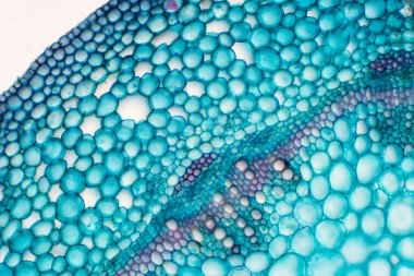 Eğitim bitkisi fizyolojisi için mikroskop altında bitki sapının çapraz bölümleri.