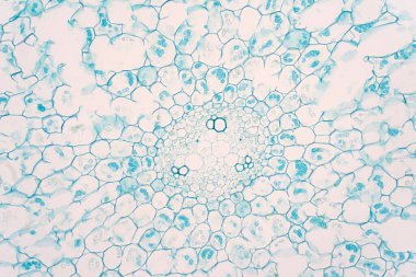 Bitki kökünün eğitim bitkisi fizyolojisi için mikroskop altında bölümleri.