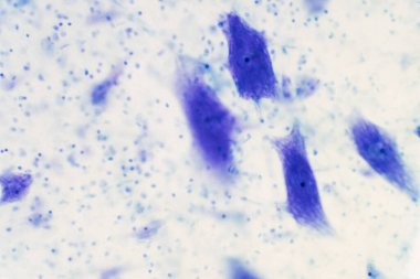 İnsan beynindeki nöronlar ve sinir sistemi. İnsan beyin dokusunun tariholojisi. Fotoğraf mikroskop altında.