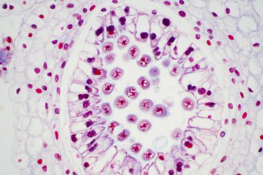 Eğitim için mikroskop bakış açısıyla bakıldığında Lily 'nin başka bir kesiti.