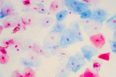 Mikroskop altında insan rahim boynunda sineksi epitel hücreler. Pap smear testi kadınlarda rahim kanseri için yapılan bir testtir..