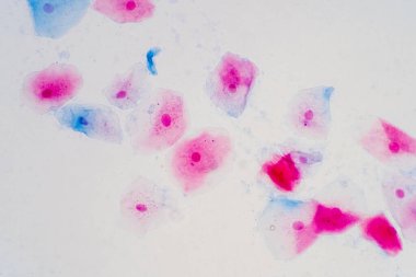 Mikroskop altında insan rahim boynunda sineksi epitel hücreler. Pap smear testi kadınlarda rahim kanseri için yapılan bir testtir..