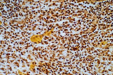 Retiküler hücre bir tür fibroblast. Dalak, lenf düğümleri ve lenf nodülleri de dahil olmak üzere birçok dokuda bulunur. İnsan Patolojisi.