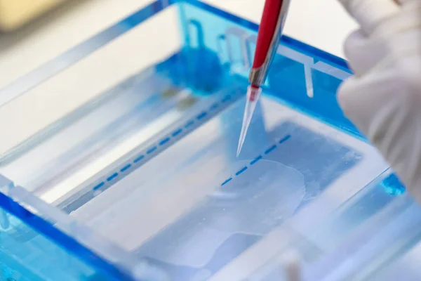 Molecular technique gel electrophoresis for DNA sample method decrypt the genetic code. biochemistry and clinical chemistry in laboratory.