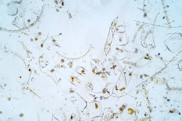 Морський Водний Планктон Під Мікроскопом — стокове фото