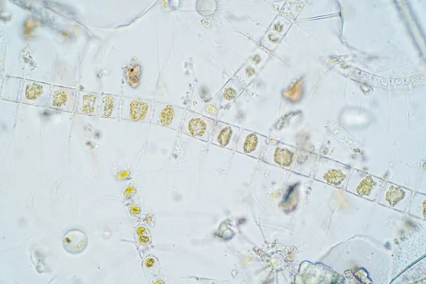 Plancton Aquatique Marin Sous Vue Microscope — Photo