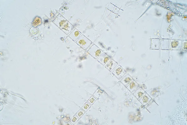 Plâncton Aquático Marinho Sob Visão Microscópica — Fotografia de Stock