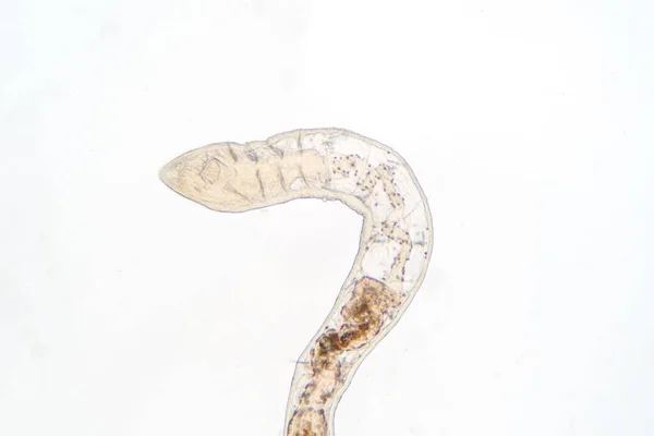教育显微镜下的Tubifex蠕虫 — 图库照片