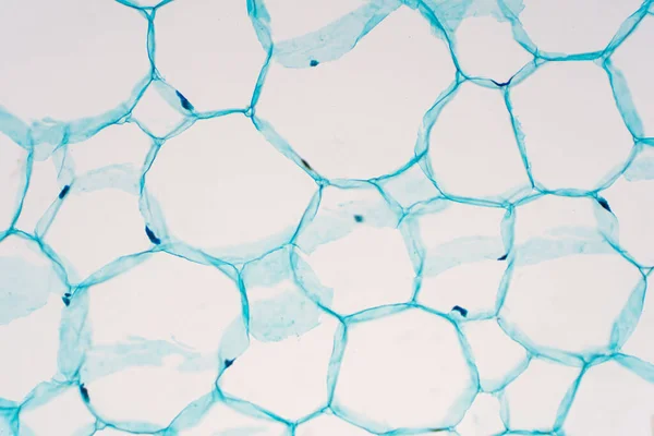 Secciones Transversales Del Tallo Planta Bajo Microscopio Ver Mostrar Estructura —  Fotos de Stock