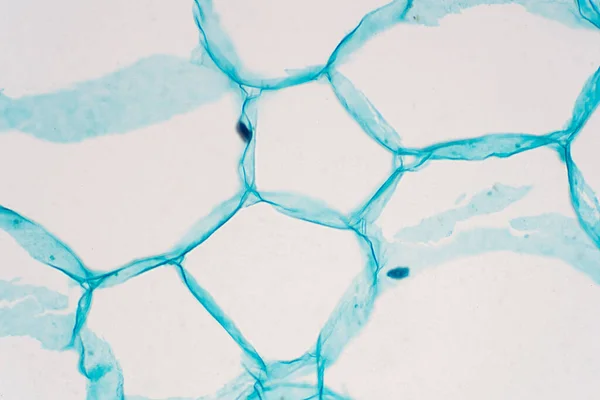 Secções Transversais Caule Planta Sob Visão Microscópio Mostram Estrutura Das — Fotografia de Stock