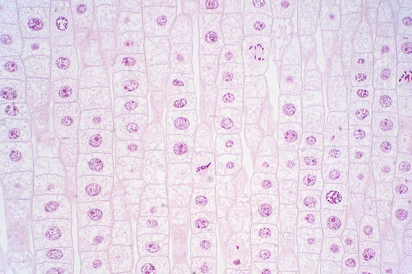 Root Tip Onion Show Mitosis Cell Root Tip Microscope View — Stock Photo, Image