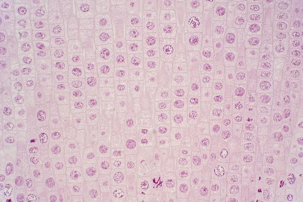 Korzeń Końcówki Cebuli Pokazują Komórkę Mitozy Korzeniowej Końcówce Pod Mikroskopem — Zdjęcie stockowe