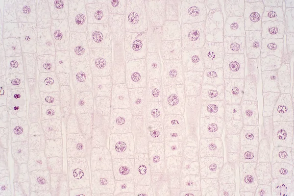 Kořenový Hrot Cibule Ukazuje Mitózu Hrotu Kořene Pod Mikroskopickým Pohledem — Stock fotografie