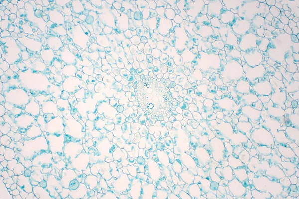 Cross sections of plant root under microscope view for education plant physiology.