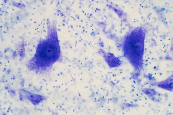Neuronas Sistema Nervioso Cerebro Humano Histología Del Tejido Cerebral Humano —  Fotos de Stock