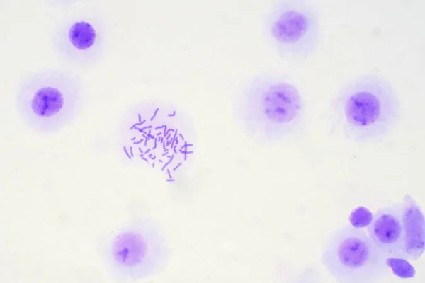 Menselijke Chromosomen Uit Bloed Onder Microscoop Bekijken Voor Onderwijs — Stockfoto